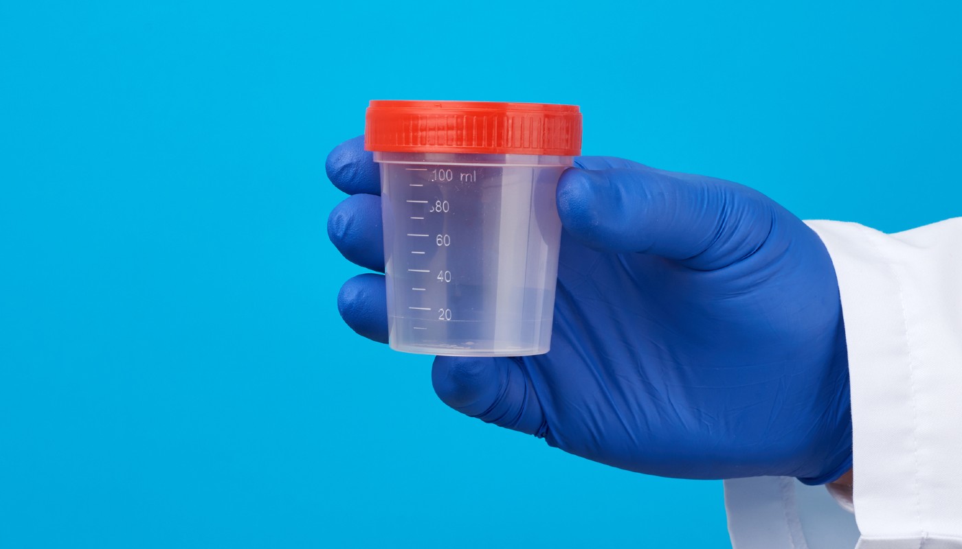 Employee who refused a drug test at work loses unfair dismissal case